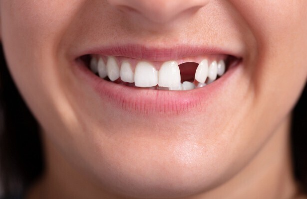 5. Плохие зубы